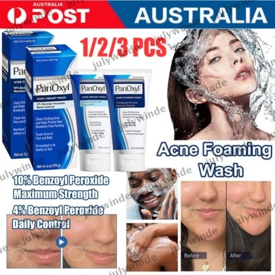 PanOxyl Benzoyl Peroxide 10% Foaming Acne Wash Skin Care 4% Daily Control Cream - image 1 of 4