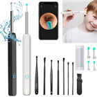 11/8 Ear Tools WiFi Visible Wax Elimination Spoon 1080P Load Otoscope With Light