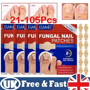 Parche antiséptico para uñas de los pies de larga duración transpirable para uñas de hongos 21 piezas - Imagen 1 de 11