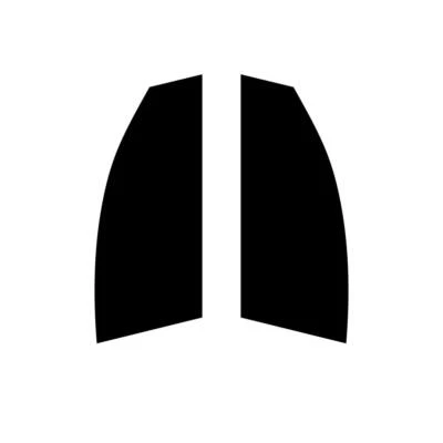 Pre Cut Car Window Tint for Chevrolet Kalos 3-door Hatchback 2004-07 Front Film - Image 1 of 4