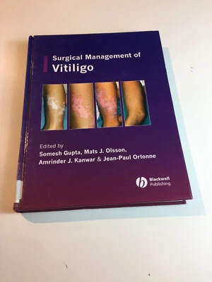 Surgical Management of Vitiligo - Image 1 of 4