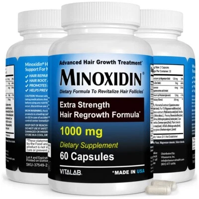Minoxidin 1000mg Hair Growth Pills For Men & Women Hair Regrowth Extra Strength - Image 1 of 4
