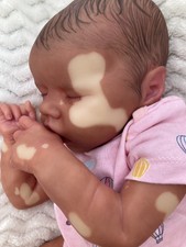 Twin a reborn baby by Bonnie brown doll with vitiligo