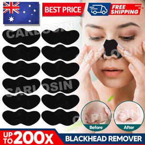 UPTO 200x Blackhead Remover Nose Face Mask Strips Black Head Pore Acne Mask AU - Picture 1 of 16