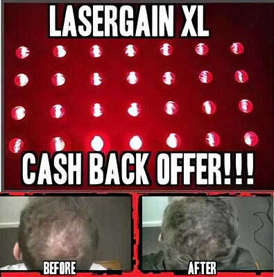 Laser Comb Hair Growth Loss Regrowth Treatment (28x More Power Than Others!) - Image 1 of 4