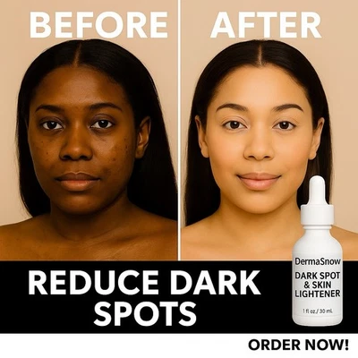 Dark Spot Remover – Melasma Corrector Serum - Ultra Brightening Fade Treatment - Image 1 of 4