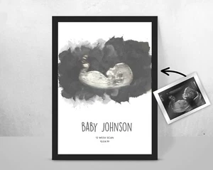 Personalised BABY Scan Ultrasound Watercolour Print/ New Mum/ Mother gift idea - Picture 1 of 3