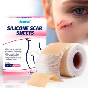 4*1.5 cm Silicone Scar Sheets Adjustable Gel Patches Removal Repair Stickers~. - Zdjęcie 1 z 15