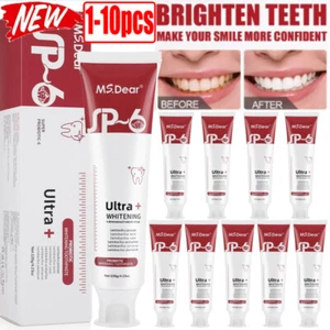 1-10PCS SP-6 Probiotics Bright White Zahnpasta, frischer Atem, Super Probiotic-6 - Bild 1 von 35