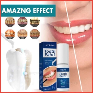 Teeth Whitening Gel Kit - Amazing Results Say Hi To Your Smile, Home Dental Kit