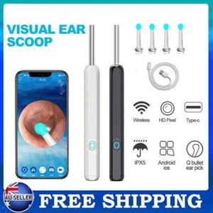 Ear Wax Remover Ear Cleaner Removal Camera Cleaning Pick Tool LED Light Scoop - Picture 1 of 21