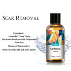 30Ml Essential Oils Therapeutic Grade Oil For Diffuser,Aromatherapy,Massage,Skin