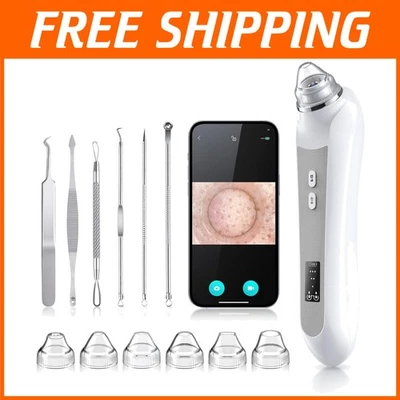 Blackhead Remover Vacuum with Camera & 6 Suction Heads - Image 1 of 4
