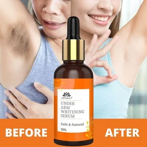 INTIMIFY Underarm Whitening Serum (10ml) Armpit Brightening Natural Formula - Picture 1 of 8