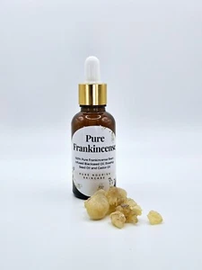 Frankincense Resin Face Oil, FRANKINCENSE, Organic, Boswellic Acid - Picture 1 of 2