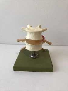 Somso Hernia de Disco Intervertebral Dorsolateral Modelo Anatómico QS67 - Imagen 1 de 4
