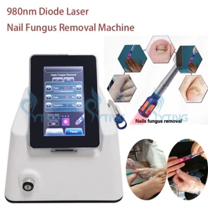 Máquina de eliminación de hongos en uñas láser diodo 980nm tratamiento de infección en uñas de los pies - Imagen 1 de 9