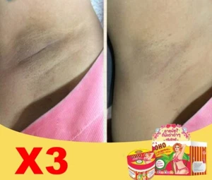X3 OHO Underarm Whitening Cream Clear Dark Soft Smooth Brigthening Armpit Skin - Picture 1 of 12