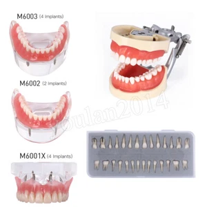 Modelo Dental Typodont con dientes removibles Demostración de estudio de enseñanza permanente - Imagen 1 de 43