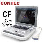 Farbdoppler Ultraschallscanner tragbarer Laptop Maschine Farbdiagnose konvex