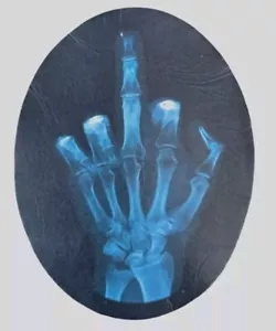 SKELETT XRAY MITTEL FU FINGER BIKER MOTORRAD LEDER AUFNÄHEN PATCH 4,5 X 3,5" - Bild 1 von 3