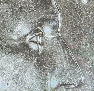 2024-P  Patsy Takemoto Mink Quarter  WDDO-003  &  WDDR-002  Awesome Coin - Picture 1 of 9