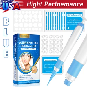 Auto Micro Skin Tag Remover Device Kit Safe Painless Removal Band Tool (Blue) US - Picture 1 of 7
