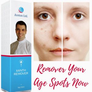 The Age Spots Removal Solution the XanthRemover 2, The specialised Peel 