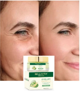 Under Eye Cream Gel for Dark Circles, Puffy Eyes, Wrinkles & Removal (20 g) Womm - Picture 1 of 8