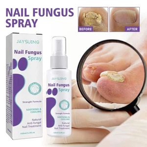 Medinail Fungus Spray Zehennagel-Pilz-Behandlung Nagelpilz-Behandlung für Zehenn - Bild 1 von 17