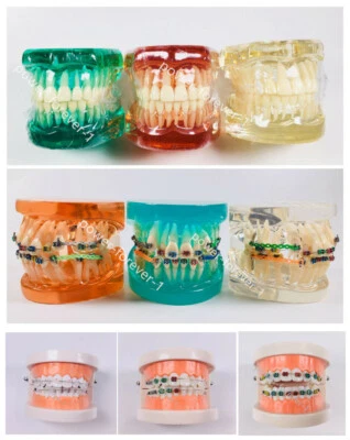 Dental Model Study Typodont Standard Orthodontic Brackets Wires Tie Anchor Screw - Image 1 of 4