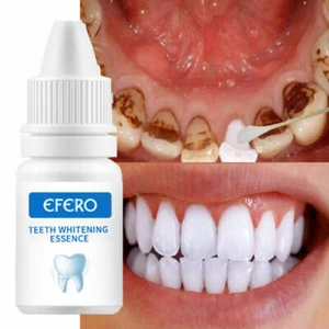 Teeth Whitening Serum Powder Oral Cleaning Remove Plaque Stains Tooth Bleaching - Picture 1 of 15