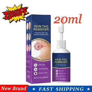 Warts Removal Spray Warts Treatment Spray Skin Tag Painless Remover-Liquids Hot - Bild 1 von 15