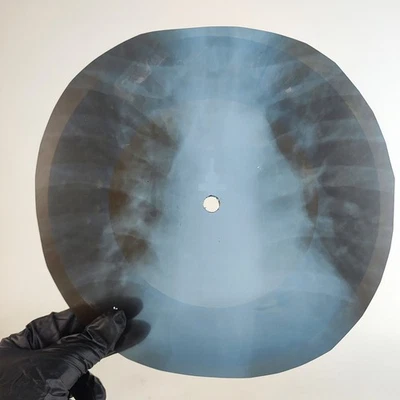 LED ZEPPELIN WHEN THE LEVEE X-Ray USSR Record Roentgen Bone Ribs Music Vinyl - Image 1 of 2