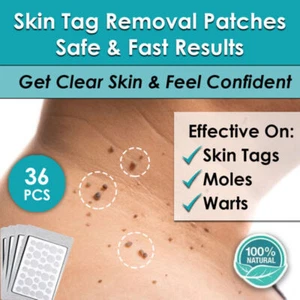 SKIN TAG REMOVER PATCHES NATURAL TREATMENT MOLES WARTS SAFE NO PAIN SCARS - Bild 1 von 7