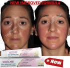 Strong Removal Melasma Whitening Cream Freckle Speckle Sunburn Spots Pigment FS