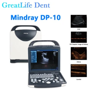 Macchina scanner ultrasuoni portatile ecografia diagnostica immagine ostetrica,FDA CE - Foto 1 di 12