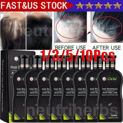 8/10x Dexe Original Anti Hair Loss Shampoo Natural Herbal Hair Growth Treatment - Image 1 of 4