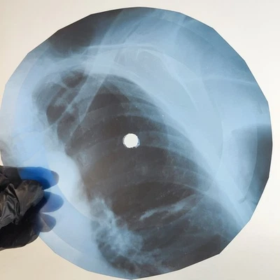 VELVET UNDERGROUND I FOUND A R/ X-Ray USSR Record Roentgen Bone Ribs Music Vinyl Foto 1 de 2