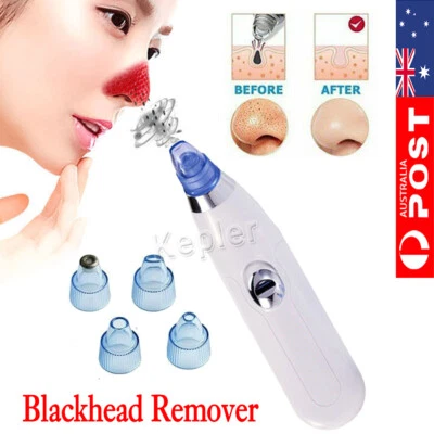 Vacuum Blackhead Remover Facial Skin Pore Acne Pimple 4Sucker Cleaner Machine - image 1 of 4