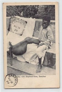 Tansania - SANSIBAR - Junge mit Elephantiasis - Publ. A. C. Gomes & Son - Bild 1 von 2