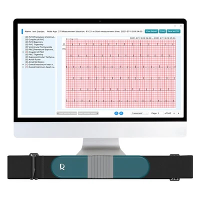 AI Holter Monitor 24 Hrs Chest Strap EKG Monitor with Free AI Analysis PC Report - Image 1 of 4