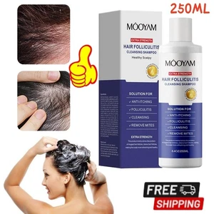 ✨Shampoo antifungo per follicolite, seborroico, 250 ml forfora / 8,4 once T U K - Foto 1 di 21