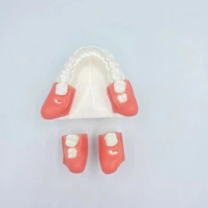 Extracción dental impactada modelo de práctica producto de entrenamiento dental - Imagen 1 de 8