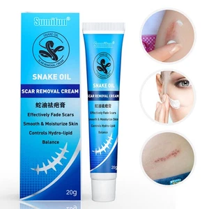 20G Scar Removal Cream For Remove Burns Cuts Ointment Marks Skin Repair - Picture 1 of 8