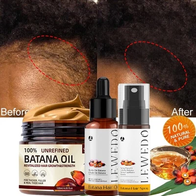 Natural Batana Oil Serum For Hair Growth Healthier Thicker Fuller Anti-Hair Loss - Image 1 of 4