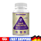 iMATCHME HAIR FAST GROWTH HERBAL PILLS PREVENT ANTI LOSS STIMULATED 5000MCG