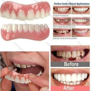 2 X Zahnprothese Zahnverblendung Zahnersatz Reparatur für Unterkiefer Oberkiefer