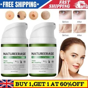 New Skin Erase Instant Mole & Spot Cream,Dark Spot Remover for Face and Body - Picture 1 of 9