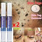 2X Painless Wart Remover Pen Eliminate Skin Tag Foot Corn Mole Warts Restoration